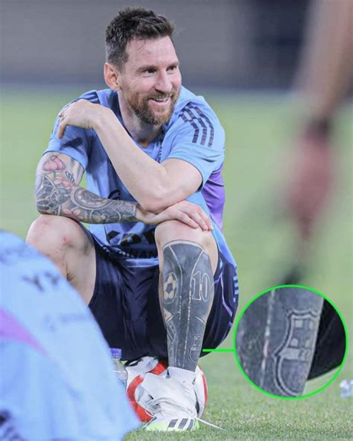 Did Lionel Messi have leg surgery?
