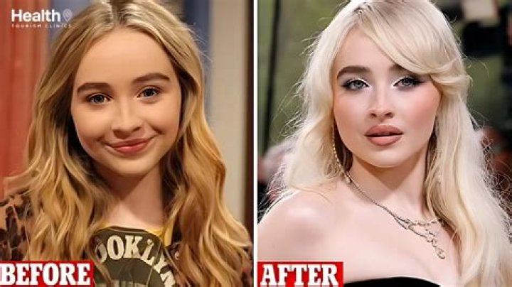 Sabrina Carpenter's Rhinoplasty: Unveiling The Truth Behind The Transformation