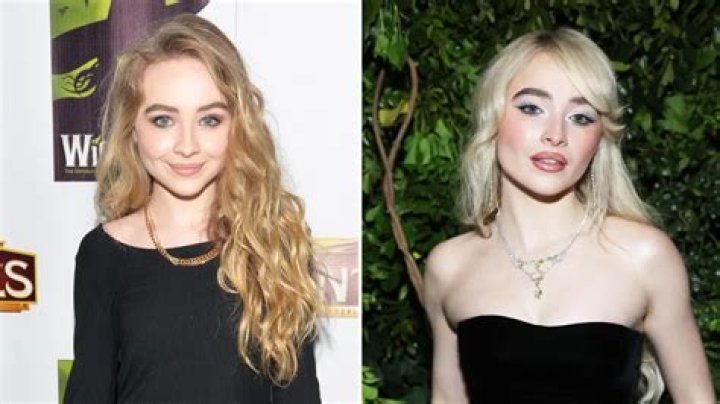 Unveiling The Truth: Does Sabrina Carpenter Have Botox?